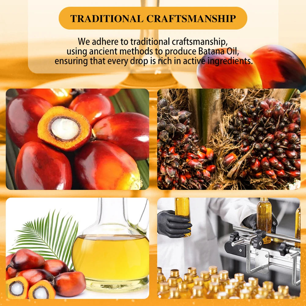 Sharmnlace™ Batana Oil Hair Care Set – Strengthen Roots & Boost Growth Naturally